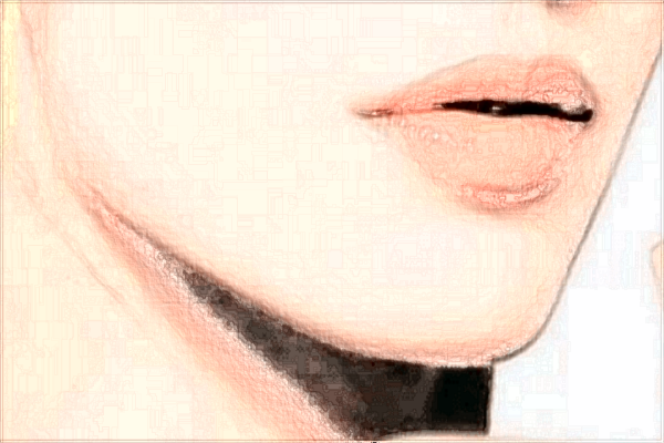 浙江醫(yī)院正頜價(jià)格怎么樣?正頜手術(shù)風(fēng)險(xiǎn)大嗎