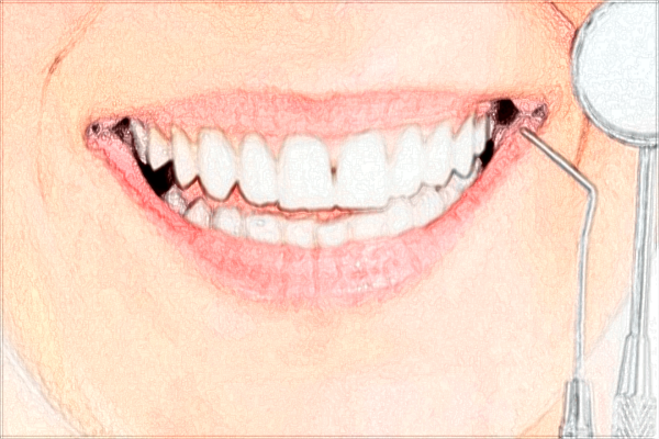 2024種牙多少錢一顆?植牙和種牙的區(qū)別