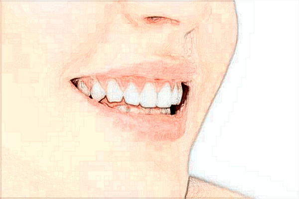 2024重慶解放軍324醫(yī)院口腔科牙齒美白怎么樣_牙齒美白對牙齒有傷害嗎