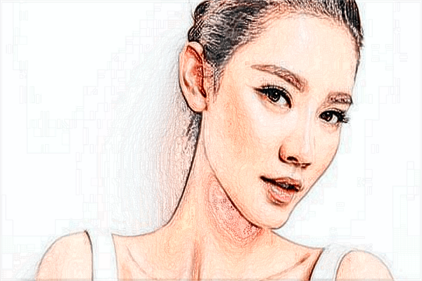 上海時(shí)光整形醫(yī)院去紅血絲怎么樣【附激光去紅血絲案例】