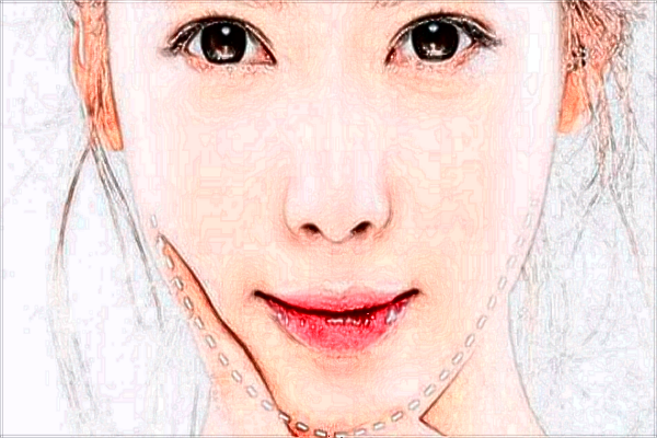 玻尿酸豐面頰會(huì)下垂嗎?玻尿酸豐面頰會(huì)僵硬嘛?