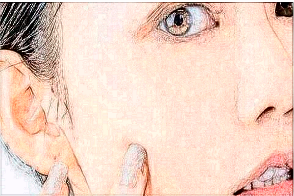 玻尿酸豐面頰會(huì)下垂嗎?玻尿酸豐面頰會(huì)僵硬嘛?