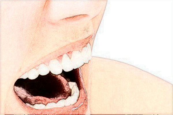 2024補(bǔ)牙多少錢(qián)一顆牙?補(bǔ)牙對(duì)牙齒有傷害嗎