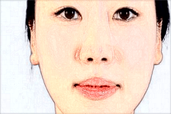 2024祛斑的一般價格?的功效與作用