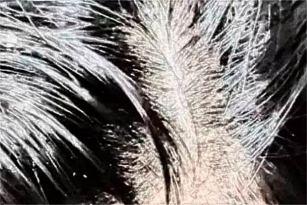 種植發(fā)際線一般多少錢?種植發(fā)際線多久能長(zhǎng)起來(lái)