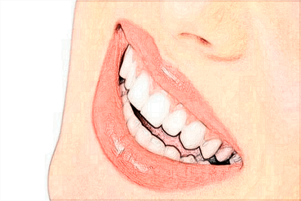 北大醫(yī)院口腔科牙齒美白價(jià)目表(價(jià)格表)怎么樣