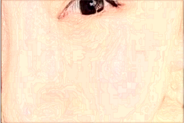 北京潤(rùn)美玉之光激光祛斑哪個(gè)醫(yī)生好_2024激光祛斑價(jià)格表