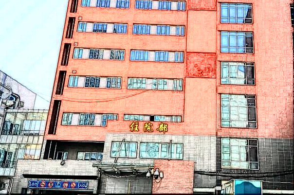 北京二院去眼袋怎么樣?2024去眼袋收費(fèi)價(jià)格