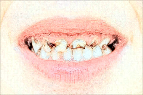 蕪湖市中醫(yī)院牙冠價(jià)格?蕪湖市中醫(yī)院牙科怎么樣