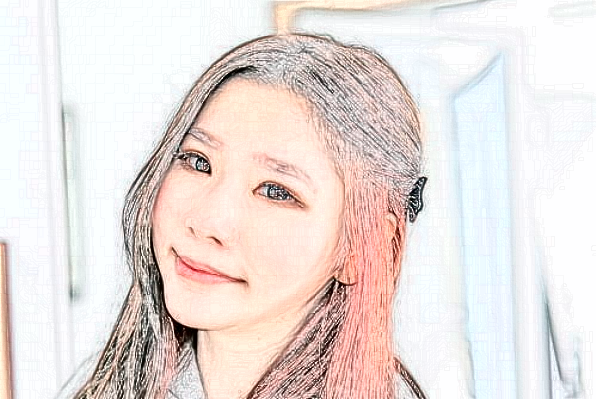 北京天壇醫(yī)院植發(fā)需要多少錢【植發(fā)案例】