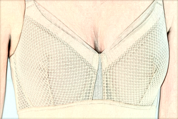 貴陽(yáng)中醫(yī)學(xué)院二附院脂肪填充怎么樣_醫(yī)生技術(shù)怎么樣