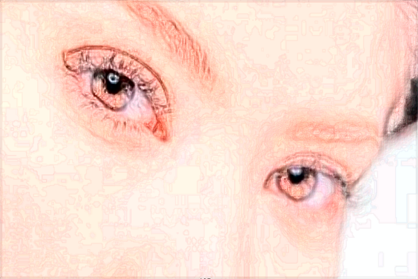 2024北京麗都去眼角細紋價格表_去眼角細紋好的方法