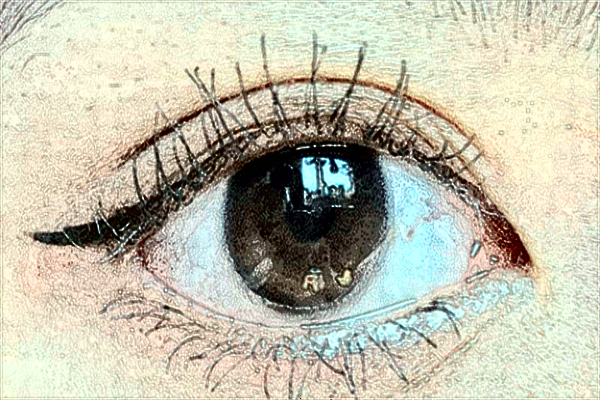 安醫(yī)附二院眼瞼矯正多少錢?眼瞼矯正手術(shù)—般多久恢復