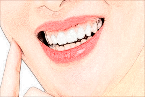 北京大學口腔醫(yī)院種植牙價格表_種植牙需要住院嗎