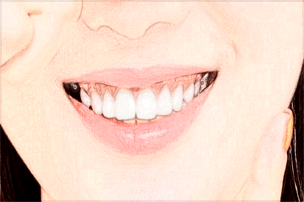 2024北京大學口腔醫(yī)院怎么樣_醫(yī)院專家介紹