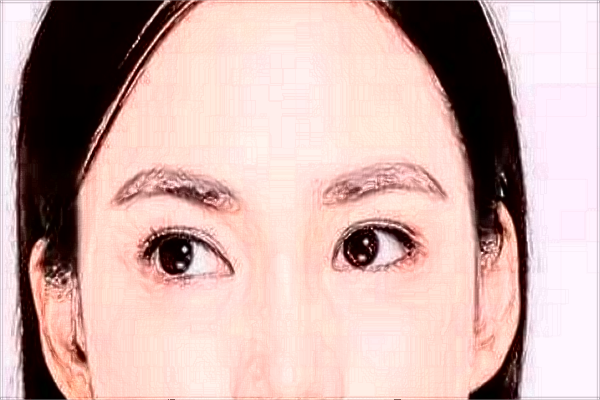 2024廣州華美哪個(gè)醫(yī)生比較好【附案例】