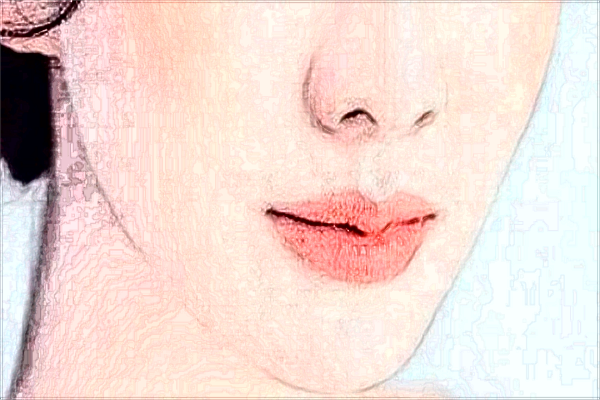 玻尿酸豐面頰打一次合適嗎?玻尿酸豐面頰會發(fā)炎嗎?