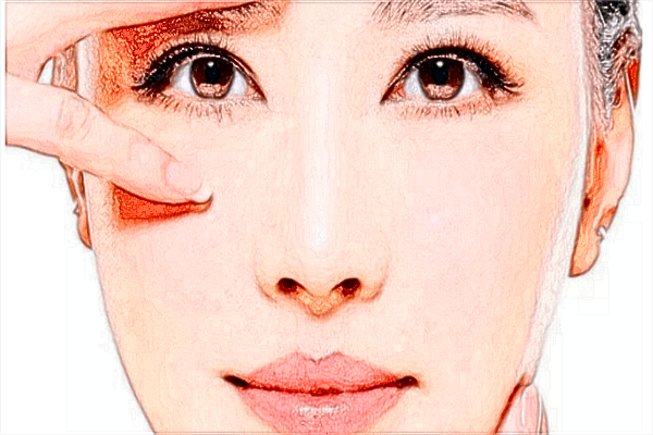 膨體隆鼻熱敷會越來越嚴重嗎?膨體隆鼻熱敷可以敷鼻子嗎?