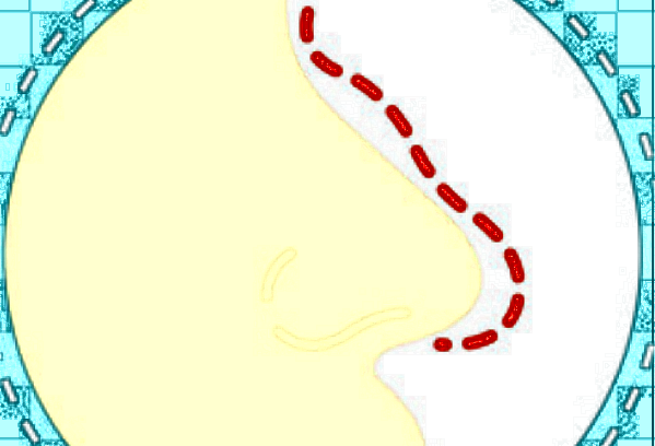 北京美萊怎么樣?一般價(jià)格多少錢