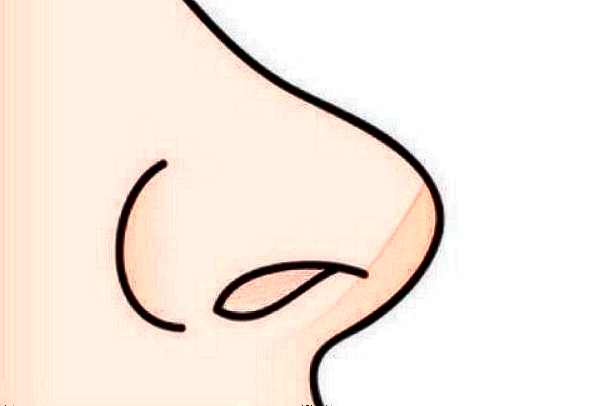 膨體隆鼻可以維持多少年?膨體隆鼻可以取出來嗎?