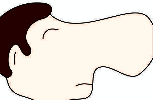 膨體隆鼻會變細(xì)變窄嗎?膨體隆鼻會回縮多少呢?