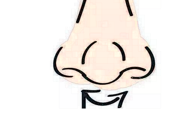 膨體隆鼻會不會越來越低?膨體隆鼻會吸收變低嗎?