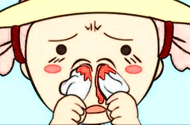 膨體隆鼻多少費(fèi)用?膨體隆鼻要忌口多長(zhǎng)時(shí)間?