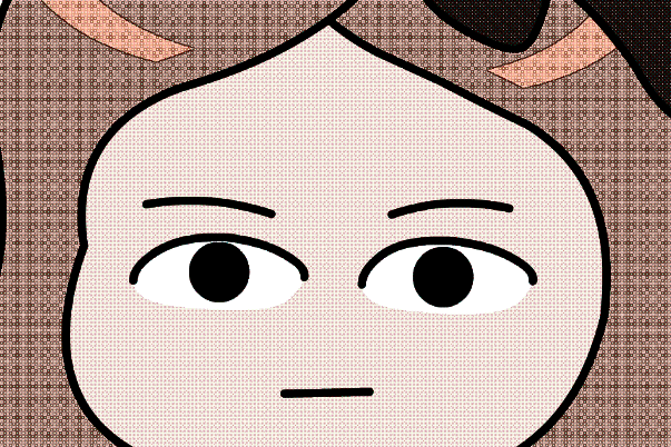 2024-2024南京市中醫(yī)院割雙眼皮的案例_大概需要多少錢