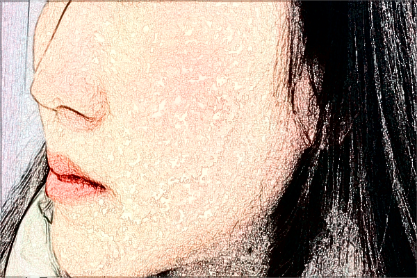 2024四川省人民醫(yī)院熱瑪吉怎么樣_哪些醫(yī)生技術比較好