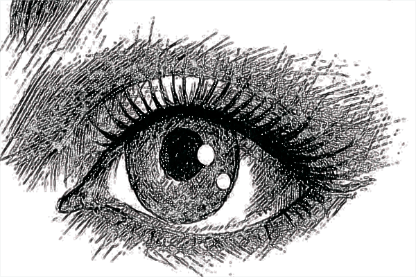 2024四川省人民醫(yī)院割雙眼皮怎么樣【雙眼皮案例】