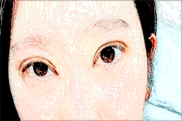 四川省人民醫(yī)院去胎記價(jià)目表(價(jià)格表)怎么樣