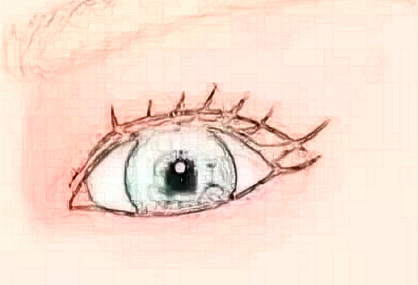 寧波二院去眼袋怎么樣?寧波二院去眼袋收費(fèi)價(jià)格