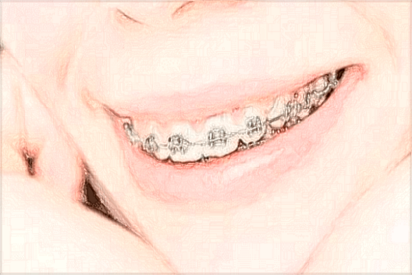 2024四川省人民醫(yī)院口腔科好不好_醫(yī)生技術哪位好