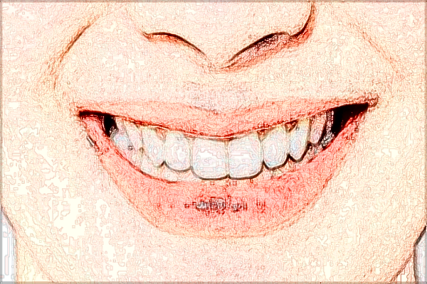 2024四川省人民醫(yī)院正畸科哪個(gè)醫(yī)生好_附醫(yī)生名單