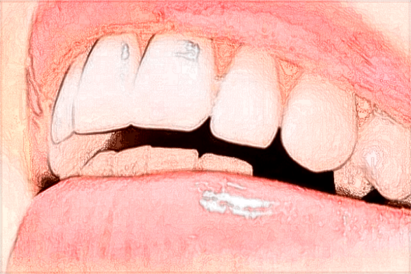 福州市第二醫(yī)院牙科怎么樣?2024牙齒矯正價格一覽