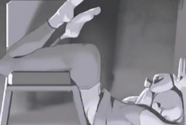 成都格萊麗抽脂做的好不好?大腿抽脂收費價格表2024