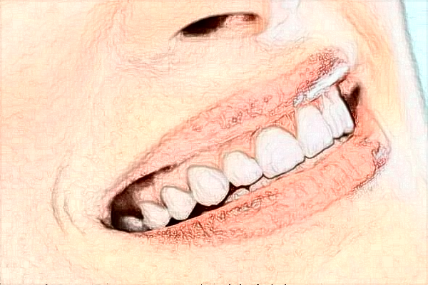 四川省人民醫(yī)院種植牙廖娟技術(shù)怎么樣【種植牙案例】