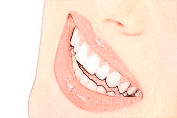 上海華山醫(yī)院烤瓷牙案例_附醫(yī)生名單推薦