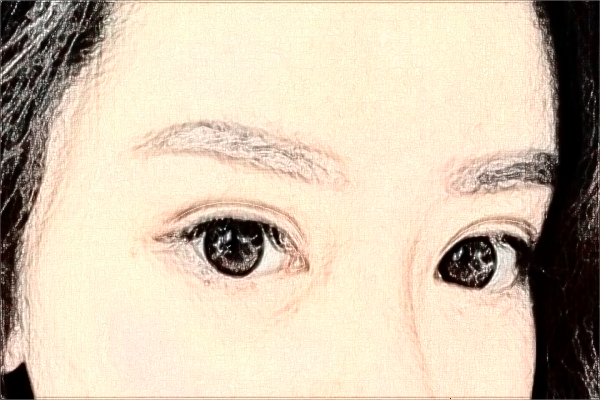 上海華山醫(yī)院玻尿酸除皺需要多少費用|怎么樣