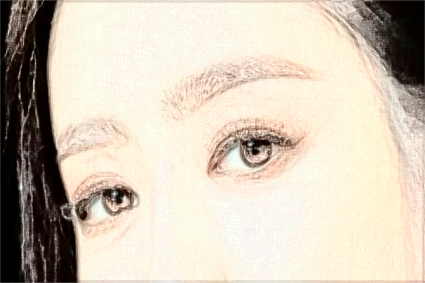 上海華山醫(yī)院玻尿酸除皺需要多少費用|怎么樣