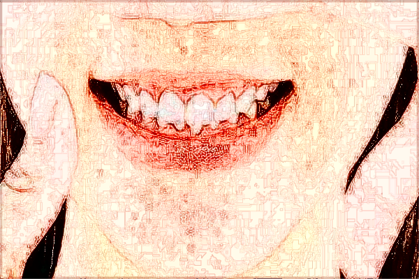 淮北市人民醫(yī)院口腔科牙醫(yī)哪個(gè)比較好_做的怎么樣