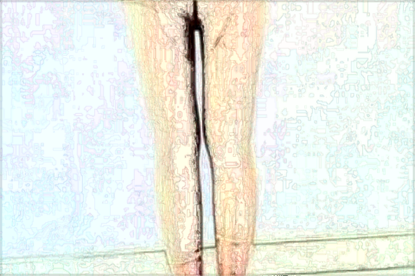 南京市中醫(yī)院激光脫毛哪位醫(yī)生做的好_收費(fèi)貴不貴