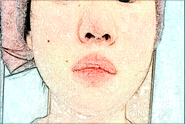 2024南京市中醫(yī)院祛斑怎么樣_哪位醫(yī)生做的比較好