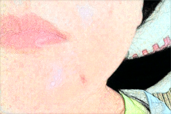 漳州175醫(yī)院頜面醫(yī)生?頜面整形的價(jià)格是多少?