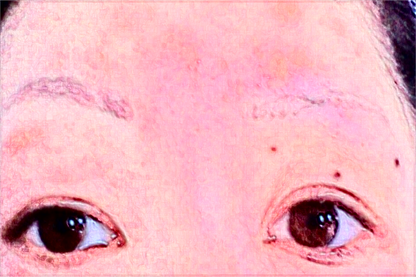 福州總醫(yī)院祛斑如何?福州總醫(yī)院祛斑價格是多少