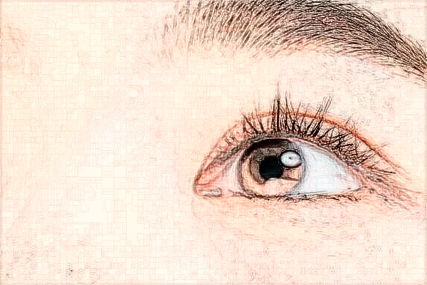 北京大學(xué)第一醫(yī)院激光點(diǎn)痣做的好嗎_哪位醫(yī)生做的比較好