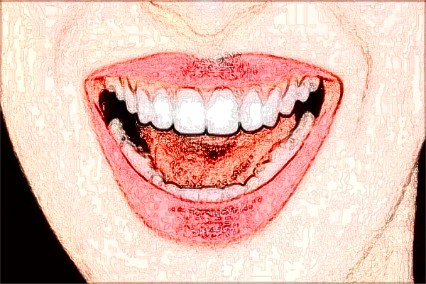 北大口腔醫(yī)院前牙修復(fù)價目表(價格表)怎么樣