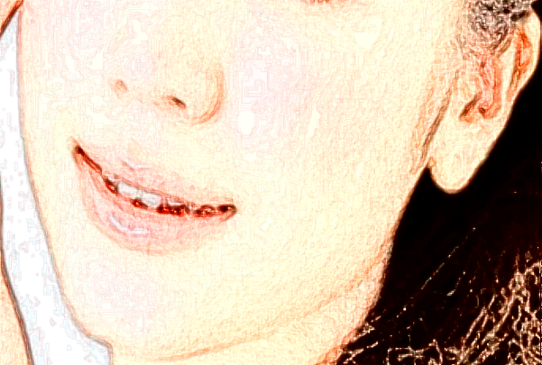 北京大學(xué)人民醫(yī)院玻尿酸怎么樣_哪些醫(yī)生做的比較好