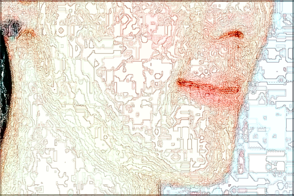 2024上海曙光醫(yī)院激光美容怎么樣_做的好不好