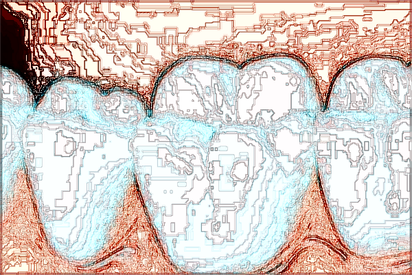 河北省口腔醫(yī)院隱形矯正價(jià)格表_做的怎么樣